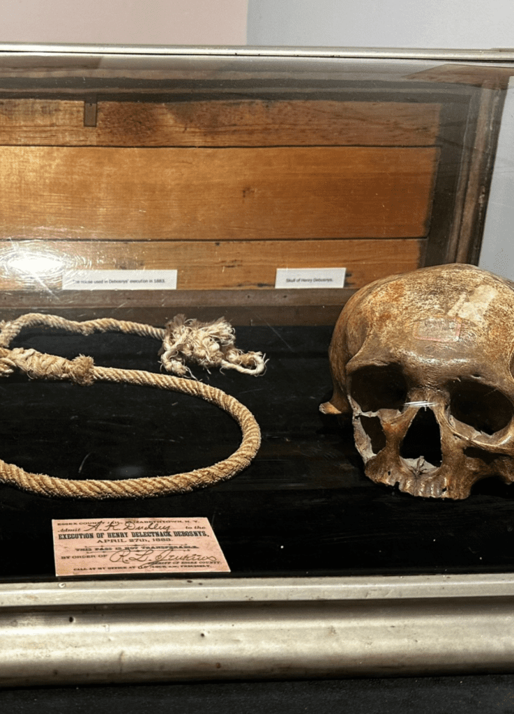 The skull of Henry Debosnys can be found at the Adirondack History Museum